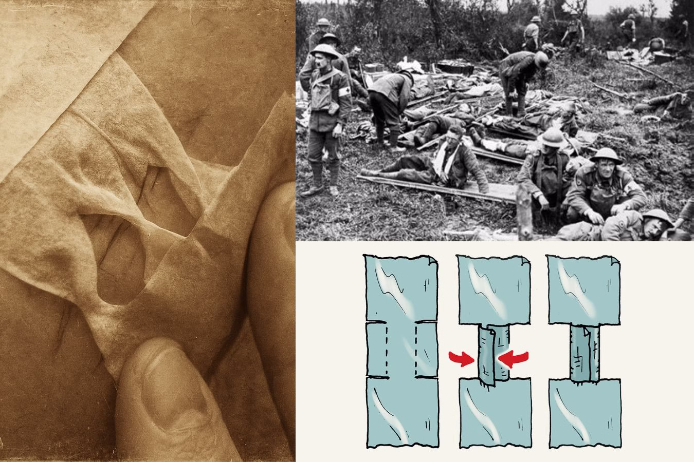 Emergency butterfly closures, DIY wound closure, Emergency first aid Survival medical techniques.